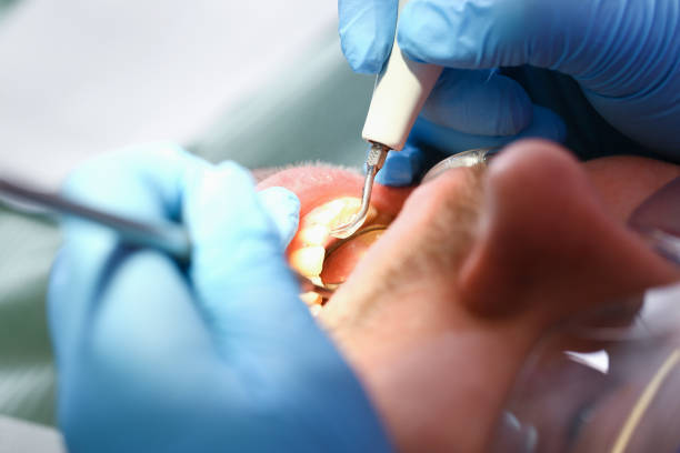 Best Urgent Dental Care  in Steelevle, IL