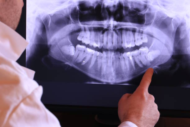 Best Emergency Tooth Extraction  in Steelevle, IL